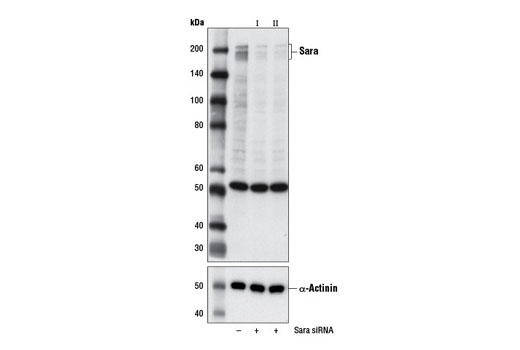 Western blot analysis of extracts from SH-SY5Y cells, transfected with 100 nM SignalSilence ® Control siRNA (Unconjugated) #6568 (-), SignalSilence ® Sara siRNA I (+) or SignalSilence ® Sara siRNA II #13553 (+), using Sara (D5X4F) Rabbit mAb #13285 (upper) or α-Actinin (D6F6) XP ® Rabbit mAb #6487 (lower). The Sara (D5X4F) Rabbit mAb confirms silencing of Sara expression, while the α-Actinin (D6F6) XP ® Rabbit mAb is used as a loading control.