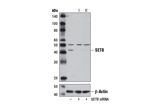 Western blot analysis of extracts from 293T cells, transfected with 100 nM SignalSilence ® Control siRNA (Unconjugated) #6568 (-), SignalSilence ® SET8 siRNA I #13067 (+) or SignalSilence ® SET8 siRNA II (+), using SET8 (C18B7) Rabbit mAb #2996 (upper) or β-Actin (D6A8) Rabbit mAb #8457 (lower). The SET8 (C18B7) Rabbit mAb, which cross-reacts with an unidentified protein at 50 kDa, confirms silencing of SET8 expression while the β-Actin (D6A8) Rabbit mAb is used as a loading control.
