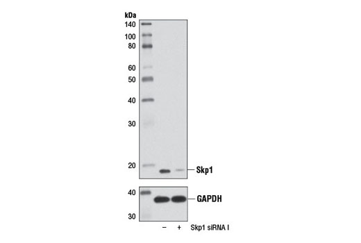 Western blot analysis of extracts from 293T cells, transfected with 100 nM SignalSilence ® Control siRNA (Unconjugated) #6568 (-) or SignalSilence ® Skp1 siRNA I (+), using Skp1 (D3J4N) Rabbit mAb #12248 (upper) or GAPDH (D16H11) XP ® Rabbit mAb #5174 (lower). The Skp1 (D3J4N) Rabbit mAb confirms silencing of Skp1 expression, while the GAPDH (D16H11) XP ® Rabbit mAb is used as a loading control.