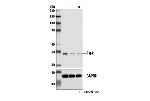 Western blot analysis of extracts from HeLa cells, transfected with 100 nM SignalSilence ® Control siRNA (Unconjugated) #6568 (-), SignalSilence ® Skp2 siRNA I #7753 (+), or SignalSilence ® Skp2 siRNA II (+), using Skp2 (L70) Antibody #4313 (upper) or GAPDH (14C10) Rabbit mAb #2118 (lower). The Skp2 (L70) Antibody confirms silencing of Skp2 expression, while the GAPDH (14C10) Rabbit mAb is used as a loading control.