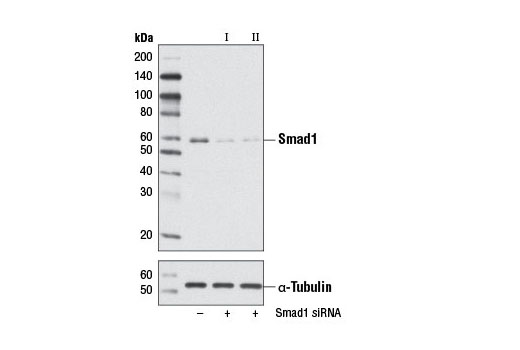 Western blot analysis of extracts from ACHN cells, transfected with 100 nM SignalSilence ® Control siRNA (Unconjugated) #6568 (-), SignalSilence ® Smad1 siRNA I #6223 (+), or SignalSilence ® Smad1 siRNA II (+) using Smad1 (D59F7) XP ® Rabbit mAb #6944 (upper) or α-Tubulin (11H10) Rabbit mAb #2125 (lower). The Smad1 (D59F7) XP ® Rabbit mAb confirms silencing of Smad1 expression, while the α-Tubulin (11H10) Rabbit mAb is used as a loading control.