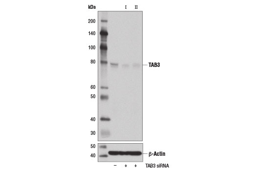 Western blot analysis of extracts from 293T cells, transfected with 100 nM SignalSilence ® Control siRNA (Unconjugated) #6568 (-), SignalSilence ® TAB3 siRNA I #14212 (+), or SignalSilence ® TAB3 siRNA II (+), using TAB3 (D5J7D) Rabbit mAb #14241 (upper) or β-Actin (D6A8) Rabbit mAb #8457 (lower). The TAB3 (D5J7D) Rabbit mAb confirms silencing of TAB3 expression, while the β-Actin (D6A8) Rabbit mAb is used as a loading control.