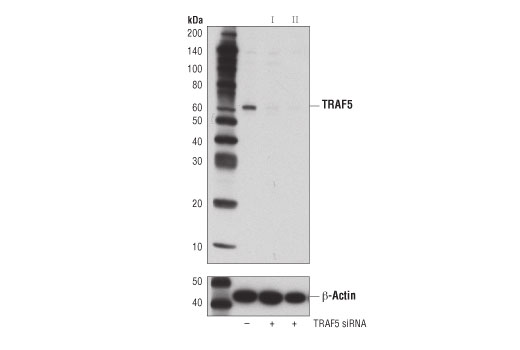 Western blot analysis of extracts from A172 cells, transfected with 100 nM SignalSilence ® Control siRNA (Unconjugated) #6568 (-), SignalSilence ® TRAF5 siRNA I (+), or SignalSilence ® TRAF5 siRNA II #60131 using TRAF5 (D3E2R) Rabbit mAb #41658 (upper) or β-Actin (D6A8) Rabbit mAb #8457 (lower). The TRAF5 (D3E2R) Rabbit mAb confirms silencing of TRAF5 expression, while the β-Actin (D6A8) Rabbit mAb is used as a loading control.
