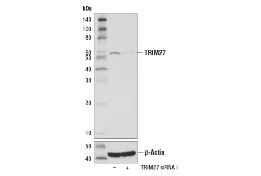 Western blot analysis of extracts from MCF7 cells transfected with 100 nM SignalSilence ® Control siRNA (Unconjugated) #6568 (-) or SignalSilence ® TRIM27 siRNA I (+), using TRIM27 (D5S4O) Rabbit mAb #15099 (upper) and β-Actin (D6A8) Rabbit mAb #8457 (lower). The TRIM27 (D5S4O) Rabbit mAb confirms silencing of TRIM27 expression, while the β-Actin (D6A8) Rabbit mAb is used as a loading control.
