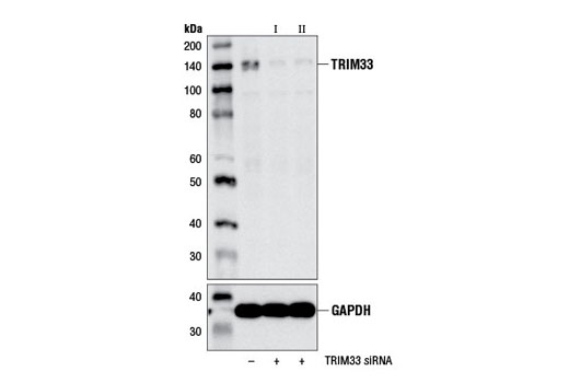 Western blot analysis of extracts from 293T cells, transfected with 100 nM SignalSilence ® Control siRNA (Unconjugated) #6568 (-), SignalSilence ® TRIM33 siRNA I #13487 (+), or SignalSilence ® TRIM33 siRNA II (+), using TRIM33 (E1N2Z) Rabbit mAb #13387 (upper) or GAPDH (D16H11) XP ® Rabbit mAb #5174 (lower). The TRIM33 (E1N2Z) Rabbit mAb confirms silencing of TRIM33 expression, while the GAPDH (D16H11) XP ® Rabbit mAb is used as a loading control.