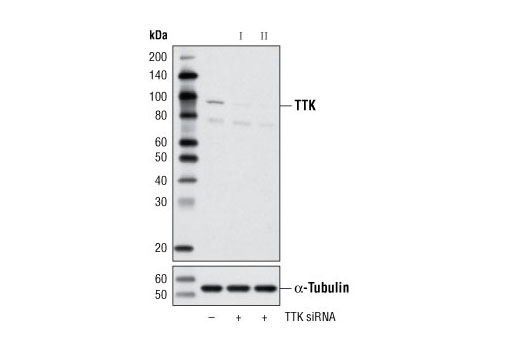 Western blot analysis of extracts from OVCAR8 cells, transfected with 100 nM SignalSilence ® Control siRNA (Unconjugated) #6568 (-), SignalSilence ® TTK siRNA I (+) or SignalSilence ® TTK siRNA II #6368 (+), using TTK (D15B7) Rabbit mAb #5469 (upper) or α-Tubulin (11H10) Rabbit mAb #2125 (lower). The TTK (D15B7) Rabbit mAb confirms silencing of TTK expression, while the α-Tubulin (11H10) Rabbit mAb is used as a loading control.