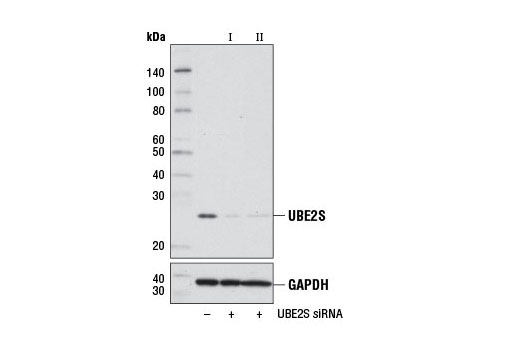 Western blot analysis of extracts from 293T cells, transfected with 100 nM SignalSilence ® Control siRNA (Unconjugated) #6568 (-), SignalSilence ® UBE2S siRNA I #7220 (+), or SignalSilence ® UBE2S siRNA II (+), using UBE2S Antibody #9630 (upper) or GAPDH (D16H11) XP ® Rabbit mAb #5174 (lower). The UBE2S Antibody confirms silencing of UBE2S expression, while the GAPDH (D16H11) XP ® Rabbit mAb is used as a loading control.