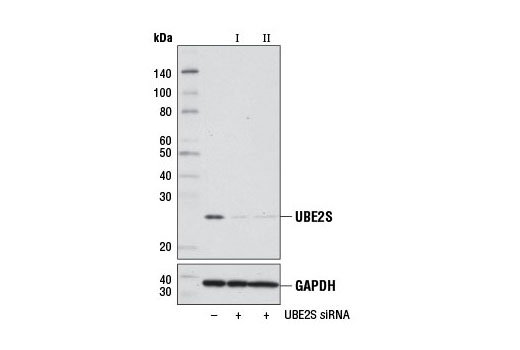 Western blot analysis of extracts from 293T cells, transfected with 100 nM SignalSilence ® Control siRNA (Unconjugated) #6568 (-), SignalSilence ® UBE2S siRNA I (+), or SignalSilence ® UBE2S siRNA II #7732 (+), using UBE2S Antibody #9630 (upper) or GAPDH (D16H11) XP ® Rabbit mAb #5174 (lower). The UBE2S Antibody confirms silencing of UBE2S expression, while the GAPDH (D16H11) XP ® Rabbit mAb is used as a loading control.