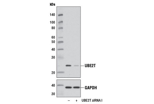 Western blot analysis of extracts from 293T cells, transfected with 100 nM SignalSilence ® Control siRNA (Unconjugated) #6568 (-) or SignalSilence ® UBE2T siRNA I (+), using UBE2T (D2L7H) Rabbit mAb #12992 (upper) or GAPDH (D16H11) XP ® Rabbit mAb #5174 (lower). The UBE2T (D2L7H) Rabbit mAb confirms silencing of UBE2T expression, while the GAPDH (D16H11) XP ® Rabbit mAb is used as a loading control.