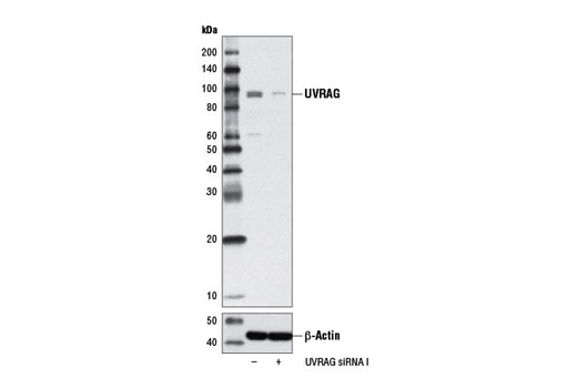 Western blot analysis of extracts from MCF7 cells, transfected with 100 nM SignalSilence ® Control siRNA (Unconjugated) #6568 (-) or SignalSilence ® UVRAG siRNA I (+), using UVRAG (D2Q1Z) Rabbit mAb #13115 (upper) or β-Actin (D6A8) Rabbit mAb #8457 (lower). The UVRAG (D2Q1Z) Rabbit mAb confirms silencing of UVRAG expression, while the β-Actin (D6A8) Rabbit mAb is used as a loading control.