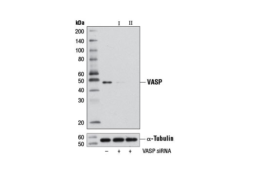 Western blot analysis of extracts from HeLa cells, transfected with 100 nM SignalSilence ® Control siRNA (Unconjugated) #6568 (-), SignalSilence ® VASP siRNA I (+) or SignalSilence ® VASP siRNA II #7658 (+), using VASP (9A2) Rabbit mAb #3132 (upper) or α-Tubulin (11H10) Rabbit mAb #2125 (lower). The VASP (9A2) Rabbit mAb confirms silencing of VASP expression, while the α-Tubulin (11H10) Rabbit mAb is used as a loading control.
