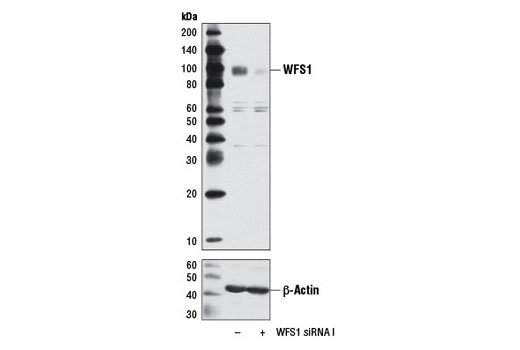 Western blot analysis of extracts from HeLa cells, transfected with 100 nM SignalSilence ® Control siRNA (Unconjugated) #6568 (-) or SignalSilence ® WFS1 siRNA I (+), using WFS1 Antibody #8749 (upper) and β-Actin (13E5) Rabbit mAb #4970 (lower). The WFS1 Antibody confirms silencing of WFS1 expression, while the β-Actin (13E5) Rabbit mAb is used as a loading control.