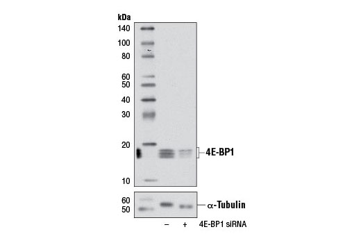 Western blot analysis of extracts from HeLa cells, transfected with 100 nM SignalSilence ® Control siRNA (Unconjugated) #6568 (-) or SignalSilence ® 4E-BP1 siRNA I (+), using 4E-BP1 (53H11) Rabbit mAb #9644 and α-Tubulin (11H10) Rabbit mAb #2125. The 4E-BP1 (53H11) Rabbit mAb confirms silencing of 4E-BP1 expression, while the α-Tubulin (11H10) Rabbit mAb is used as a loading control.