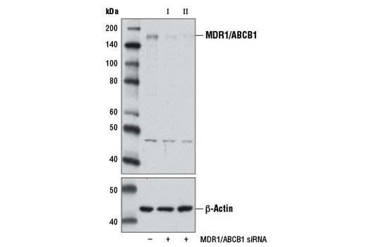 Western blot analysis of extracts from DLD-1 cells, transfected with 100 nM SignalSilence ® Control siRNA (Unconjugated) #6568 (-), SignalSilence ® MDR1/ABCB1 siRNA I #11879 (+), or SignalSilence ® MDR1/ABCB1 siRNA II (+), using MDR1/ABCB1 Antibody #12273 (upper) or β-Actin (D6A8) Rabbit mAb #8457 (lower). The MDR1/ABCB1 Antibody confirms silencing of MDR1/ABCB1 expression, while the β-Actin (D6A8) Rabbit mAb is used as a loading control.