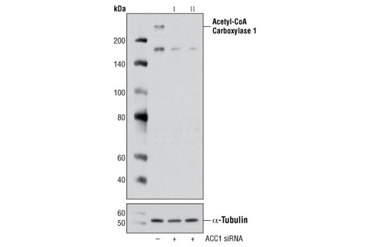 Western blot analysis of extracts from HeLa cells, transfected with 100 nM SignalSilence ® Control siRNA (Unconjugated) #6568 (-), SignalSilence ® Acetyl-CoA Carboxylase 1 siRNA I #6224 (+) or SignalSilence ® Acetyl-CoA Carboxylase 1 siRNA II (+), using Acetyl-CoA Carboxylase 1 Antibody #4190 and α-Tubulin (11H10) Rabbit mAb #2125. The Acetyl-CoA Carboxylase 1 antibody confirms silencing of Acetyl-CoA Carboxylase 1 expression while the α-Tubulin (11H10) Rabbit mAb is used as a loading control.