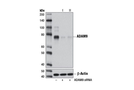 Western blot analysis of extracts from HeLa cells, transfected with 100 nM SignalSilence ® Control siRNA (Unconjugated) #6568 (-), SignalSilence ® ADAM9 siRNA I (+), or SignalSilence ® ADAM9 siRNA II #12085 (+), using ADAM9 (D64B5) Rabbit mAb #4151 (upper) or β-Actin (D6A8) Rabbit mAb #8457 (lower). The ADAM9 (D64B5) Rabbit mAb confirms silencing of ADAM9 expression, while the β-Actin (D6A8) Rabbit mAb is used as a loading control.