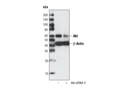 Western blot analysis of extracts from HeLa cells, transfected with 100 nM SignalSilence ® Control siRNA (Fluorescein Conjugate) #6201 (-) or SignalSilence ® Akt siRNA II (+), using Akt (pan) (11E7) Rabbit mAb #4685 and β-Actin (13E5) Rabbit mAb #4970. Akt (pan) (11E7) Rabbit mAb confirms silencing of Akt expression, while β-Actin (13E5) Rabbit mAb is used to control for loading and specificity of Akt siRNA.