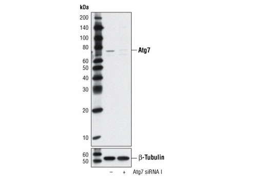 Western blot analysis of extracts from HeLa cells, transfected with 100 nM SignalSilence ® Control siRNA (Unconjugated) #6568 (-) or SignalSilence ® Atg7 siRNA I (+), using Atg7 Antibody #2631 (upper) or β-Tubulin (9F3) Rabbit mAb #2128 (lower). The Atg7 Antibody confirms silencing of Atg7 expression, while the β-Tubulin (9F3) Rabbit mAb is used as a loading control.