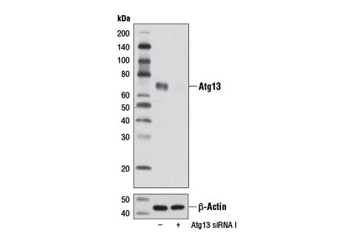 Western blot analysis of extracts from RD cells, transfected with 100 nM SignalSilence ® Control siRNA (Unconjugated) #6568 (-), or SignalSilence ® Atg13 siRNA I (+), using Atg13 Antibody #6940 (upper) or β-Actin (D6A8) Rabbit mAb #8457 (lower). The Atg13 Antibody confirms silencing of Atg13 expression, while the β-Actin (D6A8) Rabbit mAb is used as a loading control.