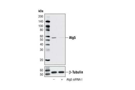 Western blot analysis of extracts from HeLa cells, transfected with 100 nM SignalSilence ® Control siRNA (Unconjugated) #6568 (-) or SignalSilence ® Atg5 siRNA I (+), using Atg5 Antibody #2630 (upper) or β-Tubulin (9F3) Rabbit mAb #2128 (lower). The Atg5 Antibody confirms silencing of Atg5 expression, while the β-Tubulin (9F3) Rabbit mAb is used as a loading control.