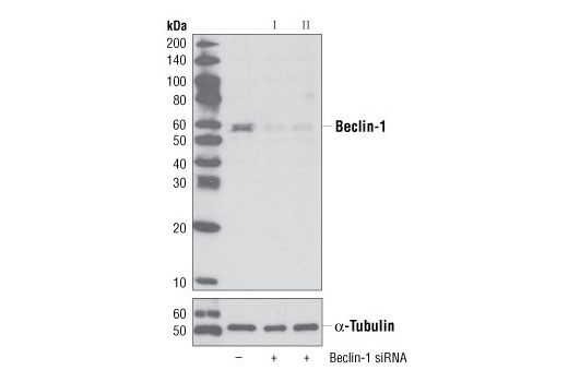Western blot analysis of extracts from HeLa cells, transfected with 100 nM SignalSilence ® Control siRNA (Unconjugated) #6568 (-), SignalSilence ® Beclin-1 siRNA I #6222 (+) or SignalSilence ® Beclin-1 siRNA II (+), using Beclin-1 (D40C5) XP ® Rabbit mAb #3495 (upper) or α-Tubulin (11H10) Rabbit mAb #2125 (lower). The Beclin-1 (D40C5) XP ® Rabbit mAb confirms silencing of Beclin-1 expression, while the α-Tubulin (11H10) Rabbit mAb is used to control for loading and specificity of Beclin-1 siRNA.