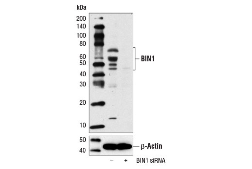 Western blot analysis of extracts from HeLa cells, transfected with 100 nM SignalSilence ® Control siRNA (Unconjugated) #6568 (-) or SignalSilence ® BIN1 siRNA I (+), using BIN1 Antibody #13679 (upper) or β-Actin (D6A8) Rabbit mAb #8457 (lower). The BIN1 Antibody confirms silencing of BIN1 expression, while the β-Actin (D6A8) Rabbit mAb is used as a loading control.