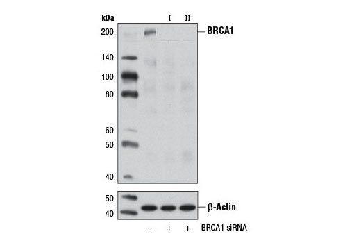 Western blot analysis of extracts from 293T cells, transfected with 100 nM SignalSilence ® Control siRNA (Unconjugated) #6568 (-), SignalSilence ® BRCA1 siRNA I (+), or SignalSilence ® BRCA1 siRNA II #12642 (+), using BRCA1 Antibody #9010 (upper) or β-Actin (D6A8) Rabbit mAb #8457 (lower). The BRCA1 Antibody confirms silencing of BRCA1 expression, while the β-Actin (D6A8) Rabbit mAb is used as a loading control.