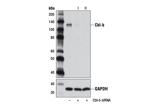 Western blot analysis of extracts from 293T cells, transfected with 100 nM SignalSilence ® Control siRNA (Unconjugated) #6568 (-), SignalSilence ® Cbl-b siRNA I (+), or SignalSilence ® Cbl-b siRNA II #12122 (+), using Cbl-b (D3C12) Rabbit mAb #9498 (upper) or GAPDH (D16H11) XP ® Rabbit mAb #5174 (lower). The Cbl-b (D3C12) Rabbit mAb confirms silencing of Cbl-b expression, while the GAPDH (D16H11) XP ® Rabbit mAb is used as a loading control.