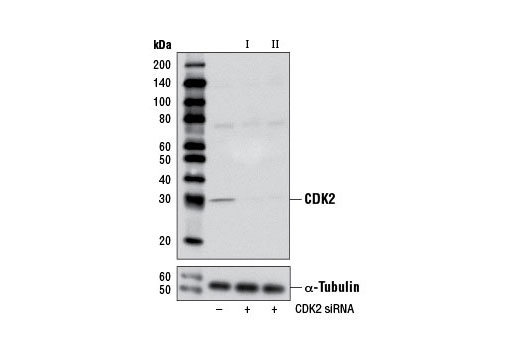 Western blot analysis of extracts from HeLa cells, transfected with 100 nM SignalSilence ® Control siRNA (Unconjugated) #6568 (-), SignalSilence ® CDK2 siRNA I (+) or SignalSilence ® CDK2 siRNA II #7417 (+), using CDK2 (78B2) Rabbit mAb #2546 (upper) or α-Tubulin (11H10) Rabbit mAb #2125 (lower). The CDK2 (78B2) Rabbit mAb confirms silencing of CDK2 expression, while the α-Tubulin (11H10) Rabbit mAb is used as a loading control.