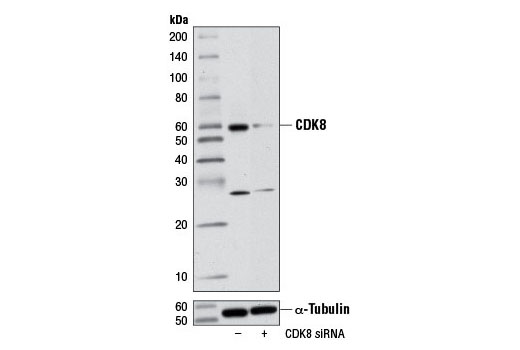 Western blot analysis of extracts from 293 cells, transfected with 100 nM SignalSilence ® Control siRNA (Unconjugated) #6568 (-) or SignalSilence ® CDK8 siRNA I (+), using CDK8 (G398) Antibody #4101 and α-Tubulin (11H10) Rabbit mAb #2125. The CDK8 (G398) Antibody confirms silencing of CDK8 expression, while the α-Tubulin (11H10) Rabbit mAb is used as a loading control.