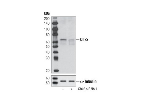Western blot analysis of extracts from HeLa cells, transfected with 100 nM SignalSilence ® Control siRNA (Unconjugated) #6568 (-) or SignalSilence ® Chk2 siRNA I (+), using Chk2 (1C12) Mouse mAb #3440 and α-Tubulin (11H10) Rabbit mAb #2125. The Chk2 (1C12) Mouse mAb confirms silencing of Chk2 expression, while the α-Tubulin (11H10) Rabbit mAb is used as a loading control.
