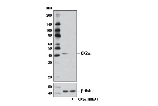 Western blot analysis of extracts from NIH/3T3 cells, transfected with 100 nM SignalSilence ® Control siRNA (Unconjugated) #6568 (-) or SignalSilence ® CK2α siRNA I (Rodent Specific) (+), using CK2α Antibody #2656 (upper) or β-Actin (D6A8) Rabbit mAb #8457 (lower). The CK2α Antibody confirms silencing of CK2α expression, while the β-Actin (D6A8) Rabbit mAb is used as a loading control.