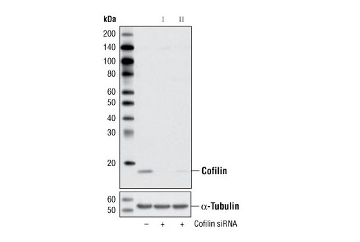 Western blot analysis of extracts from HeLa cells, transfected with 100 nM SignalSilence ® Control siRNA (Unconjugated) #6568 (-), SignalSilence ® Cofilin siRNA I (+) or SignalSilence ® Cofilin siRNA II #6268 (+), using Cofilin (D59) Antibody #3318 (upper) or α-Tubulin (11H10) Rabbit mAb #2125 (lower). The Cofilin (D59) Antibody confirms silencing of cofilin expression, while the α-Tubulin (11H10) Rabbit mAb is used as a loading control.