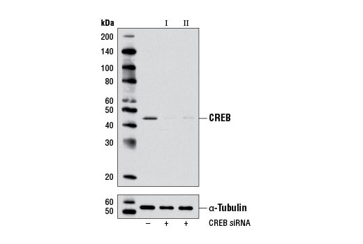 Western blot analysis of extracts from NIH/3T3 cells, transfected with 100 nM SignalSilence ® Control siRNA (Unconjugated) #6568 (-), SignalSilence ® CREB siRNA I (Mouse Specific) #6343 (+) or SignalSilence ® CREB siRNA II (Mouse Specific) (+), using CREB (48H2) Rabbit mAb #9197 (upper) or α-Tubulin (11H10) Rabbit mAb #2125 (lower). The CREB (48H2) Rabbit mAb confirms silencing of CREB expression, while the α-Tubulin (11H10) Rabbit mAb is used as a loading control.