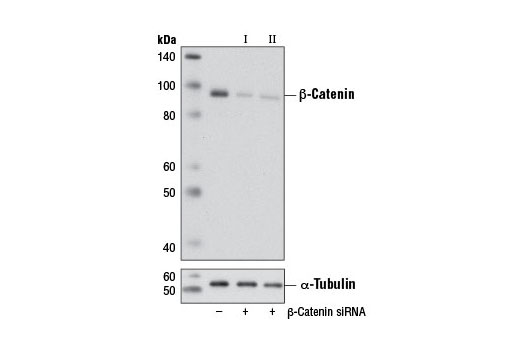 Western blot analysis of extracts from C2C12 cells, transfected with 100 nM SignalSilence ® Control siRNA (Unconjugated) #6568 (-), SignalSilence ® β-Catenin siRNA I (Mouse Specific) #6387 (+) or SignalSilence ® β-Catenin siRNA II (Mouse Specific) (+), using β-Catenin (6B3) Rabbit mAb #9582 (upper) or α-Tubulin (11H10) Rabbit mAb #2125 (lower). The β-Catenin (6B3) Rabbit mAb confirms silencing of β-Catenin expression, while the α-Tubulin (11H10) Rabbit mAb is used as a loading control.
