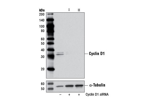 Western blot analysis of extracts from C2C12 cells, transfected with 100 nM SignalSilence ® Control siRNA (Unconjugated) #6568 (-), SignalSilence ® Cyclin D1 siRNA I (Mouse Specific) #6423 (+), or SignalSilence ® Cyclin D1 siRNA II (Mouse Specific) (+), using Cyclin D1 (92G2) Rabbit mAb #2978 (upper) or α-Tubulin (11H10) Rabbit mAb #2125 (lower). The Cyclin D1 (92G2) Rabbit mAb confirms silencing of Cyclin D1 expression, while the α-Tubulin (11H10) Rabbit mAb is used as a loading control.