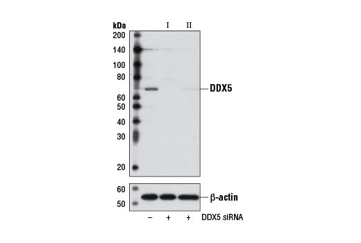 Western blot analysis of extracts from HeLa cells, transfected with 100 nM SignalSilence ® Control siRNA (Unconjugated) #6568 (-), SignalSilence ® DDX5 siRNA I #8626 (+) or SignalSilence ® DDX5 siRNA II (+), using DDX5 (D15E10) XP ® Rabbit mAb #9877 (upper) or β-Actin (13E5) Rabbit mAb #4970 (lower). The DDX5 (D15E10) XP ® Rabbit mAb confirms silencing of DDX5 expression, while the β-Actin (13E5) Rabbit mAb is used as a loading control.