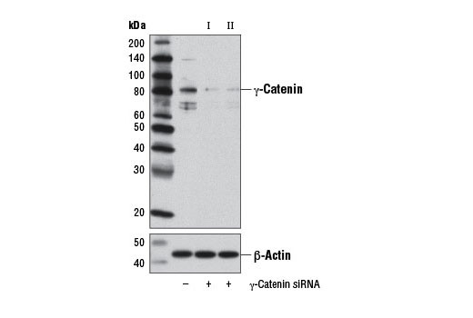 Western blot analysis of extracts from NIH/3T3 cells, transfected with 100 nM SignalSilence ® Control siRNA (Unconjugated) #6568 (-), SignalSilence ® γ-Catenin siRNA I (Mouse Specific) (+) or SignalSilence ® γ-Catenin siRNA II (Mouse Specific) #12680 (+), using γ-Catenin Antibody #2309 (upper) or β-Actin (D6A8) Rabbit mAb #8457 (lower). The γ-Catenin Antibody confirms silencing of γ-catenin expression, while the β-Actin (D6A8) Rabbit mAb is used as a loading control.