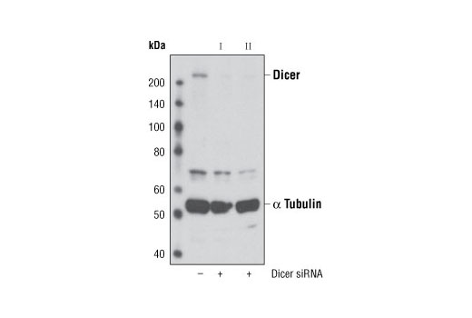 Western blot analysis of extracts from HeLa cells, transfected with 100 nM SignalSilence ® Control siRNA (Unconjugated) #6568 (-), SignalSilence ® Dicer siRNA I #6576 (+) or SignalSilence ® Dicer siRNA II (+), using Dicer Antibody #3363 and α-Tubulin (11H10) Rabbit mAb #2125. The dicer antibody confirms silencing of dicer expression, while α-Tubulin (11H10) Rabbit mAb is used to control for loading and specificity of dicer siRNA.