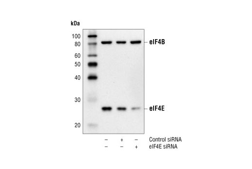 Western blot analysis of extracts from HeLa cells, untransfected or transfected with either nonspecific control siRNA or eIF4E siRNA. eIF4E was detected using eIF4E Antibody #9742, and eIF4B was detected using eIF4B Antibody #3592. The eIF4E Antibody confirms silencing of eIF4E expression, and the eIF4B Antibody is used to control for loading and siRNA specificity.