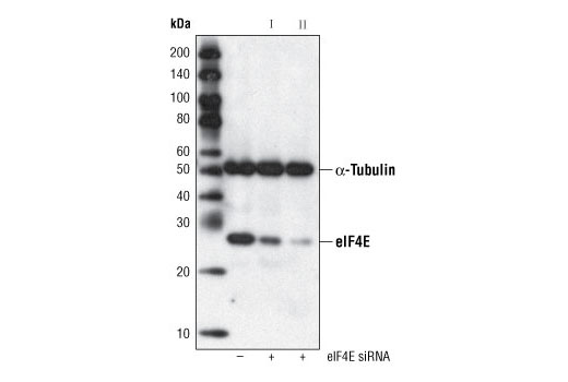 Western blot analysis of extracts from HeLa cells, transfected with 100 nM SignalSilence ® Control siRNA (Fluorescein Conjugate) #6201 (-) or SignalSilence ® eIF4E siRNA I #6311 or SignalSilence ® eIF4E siRNA II #6554 (+), using eIF4E (C46H6) Rabbit mAb #2067 and α-Tubulin (11H10) Rabbit mAb #2125. The eIF4E (C46H6) Rabbit mAb confirms silencing of eIF4E expression and α-Tubulin (11H10) Rabbit mAb is used to control for loading and specificity of eIF4E siRNA.