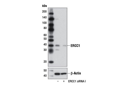 Western blot analysis of extracts from HeLa cells, transfected with 100 nM SignalSilence ® Control siRNA (Unconjugated) #6568 (-) or SignalSilence ® ERCC1 siRNA I (+), using ERCC1 (D61F5) Rabbit mAb #5437 (upper) or β-Actin (D6A8) Rabbit mAb #8457 (lower). The ERCC1 (D61F5) Rabbit mAb confirms silencing of ERCC1 expression while the β-Actin (D6A8) Rabbit mAb is used as a loading control.