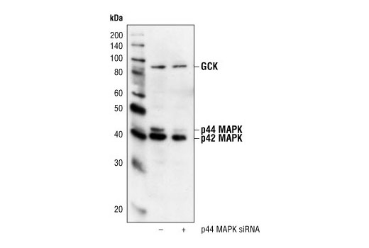 Western blot analysis of extracts from HeLa cells, transfected with 100 nM SignalSilence ® Control siRNA (Fluorescein Conjugate) #6201 (-) or SignalSilence ® p44 MAPK (Erk1) siRNA I (+), using p44/42 MAPK (Erk1/2) Antibody #9102 and GCK Antibody #3782. The Erk1/2 antibody confirms silencing of Erk1 expression and GCK antibody is used to control for loading and specificity of p44 MAPK (Erk1) siRNA.