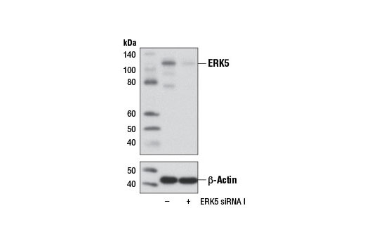 Western blot analysis of extracts from 293T cells, transfected with 100 nM SignalSilence ® Control siRNA (Unconjugated) #6568 (-) or SignalSilence ® ERK5 siRNA I (+), using Erk5 (D23E9) Rabbit mAb #3552 (upper) or β-Actin (D6A8) Rabbit mAb #8457 (lower). The Erk5 (D23E9) Rabbit mAb confirms silencing of ERK5 expression, while the β-Actin (D6A8) Rabbit mAb is used as a loading control.
