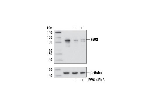 Western blot analysis of extracts from HeLa cells, transfected with 100 nM SignalSilence ® Control siRNA (Unconjugated) #6568 (-), SignalSilence ® EWS siRNA I #12175 (+), or SignalSilence ® EWS siRNA II (+), using EWS Antibody #11910 (upper) or β-Actin (D6A8) Rabbit mAb #8457 (lower). The EWS Antibody confirms silencing of EWS expression, while the β-Actin (D6A8) Rabbit mAb is used as a loading control.