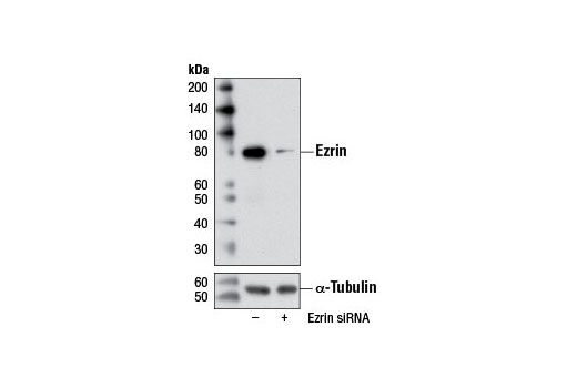 Western blot analysis of extracts from HeLa cells, transfected with 100 nM SignalSilence ® Control siRNA (Unconjugated) #6568 (-) or SignalSilence ® Ezrin siRNA I (+), using Ezrin Antibody #3145 and α-Tubulin (11H10) Rabbit mAb #2125. The Ezrin Antibody confirms silencing of ezrin expression, while the α-Tubulin (11H10) Rabbit mAb is used as a loading control.