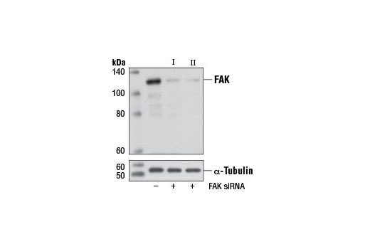 Western blot analysis of extracts from HeLa cells, transfected with 100 nM SignalSilence ® Control siRNA (Unconjugated) #6568 (-), SignalSilence ® FAK siRNA I (+) or SignalSilence ® FAK siRNA II #6483 (+), using FAK Antibody #3285 (upper) or α-Tubulin (11H10) Rabbit mAb #2125 (lower). The FAK Antibody confirms silencing of FAK expression, while the α-Tubulin (11H10) Rabbit mAb is used as a loading control.