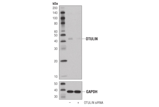 Western blot analysis of extracts from 293T cells, transfected with 100 nM SignalSilence ® Control siRNA (Unconjugated) #6568 (-) or SignalSilence ® OTULIN siRNA I (+), using OTULIN Antibody #14127 (upper) and GAPDH (D16H11) XP ® Rabbit mAb #5174 (lower). The OTULIN Antibody confirms silencing of OTULIN expression, while the GAPDH (D16H11) XP ® Rabbit mAb is used as a loading control.