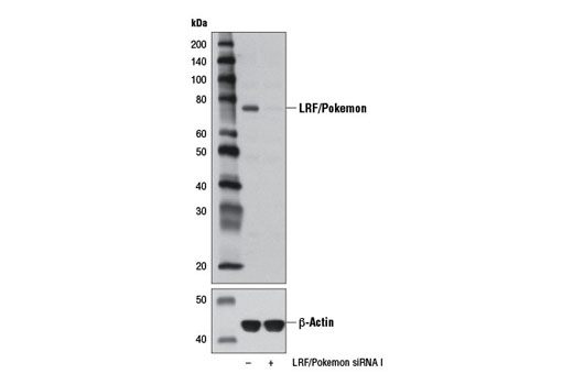 Western blot analysis of extracts from HeLa cells transfected with 100 nM SignalSilence ® Control siRNA (Unconjugated) #6568 (-) or SignalSilence ® LRF/Pokemon siRNA I (+) using LRF/Pokemon Antibody #13097 (upper) or β-Actin (D6A8) Rabbit mAb #8457 (lower). The LRF/Pokemon Antibody confirms silencing of LRF/Pokemon expression, while the β-Actin (D6A8) Rabbit mAb is used as a loading control.