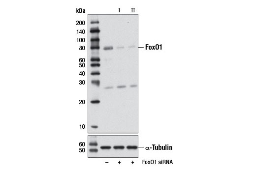 Western blot analysis of extracts from C2C12 cells, transfected with 100 nM SignalSilence ® Control siRNA (Unconjugated) #6568 (-), SignalSilence ® FoxO1 siRNA I (Mouse Specific) (+), or SignalSilence ® FoxO1 siRNA II (Mouse Specific) #6493 (+) using FoxO1 (C29H4) Rabbit mAb #2880 (upper) or α-Tubulin (11H10) Rabbit mAb #2125 (lower). The FoxO1 (C29H4) Rabbit mAb confirms silencing of FoxO1 expression, while the α-Tubulin (11H10) Rabbit mAb is used as a loading control.